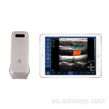 80E Lineal Mini Ultrasonund Scanner